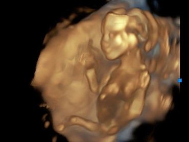 3D ultrasound baby picture full body