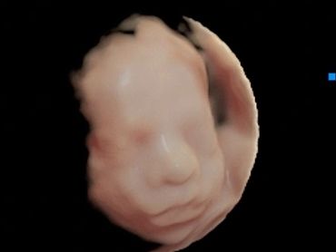 4D Ultrasound profile picture at 26 weeks