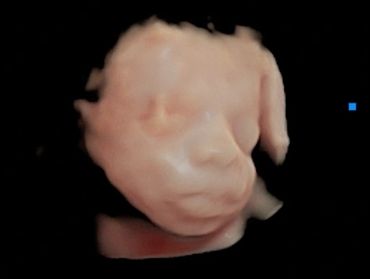 4D Ultrasound profile picture at 26 weeks