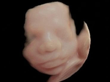 4D Ultrasound profile picture at 26 weeks