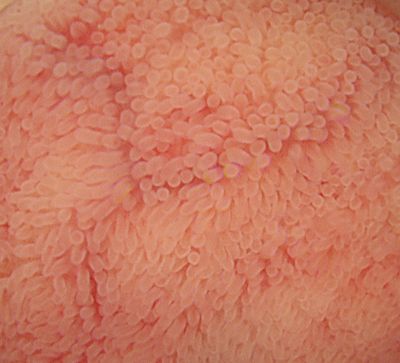 Normal terminal ileum mucosa with normal looking villi. 