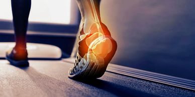 foot radiating pain running on a treadmill