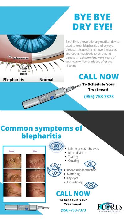 Dry Eye Syndrome