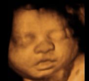 Bundle of Joy 3D 4D Studio 3d Ultrasound Beaumont Texas