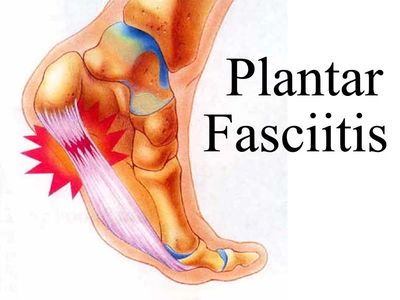 Plantar Fasciitis, Neuropathy, Leg Cramps, Hip Pain, Diabetes, Back Pain, Arthritis, Restless Legs