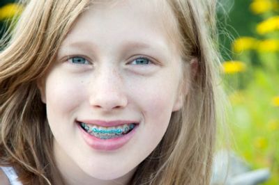 Braces - Dr. Jennifer H Yau - Family Orthodontist in Los Gatos, Campbell, and San Jose