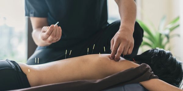 Acupuncture therapy