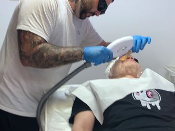 laser treatments