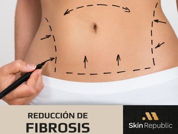 Fibrosis