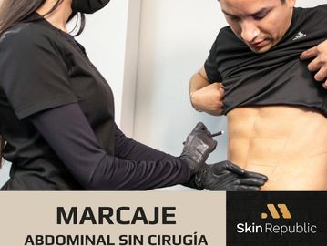 Marcaje Abdominal, Ab Sculping