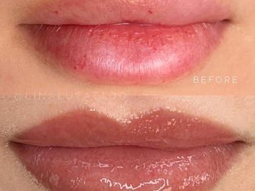 Close-up of lips before and after moisturizing treatment.