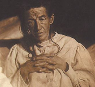 Alzheimer's first patient Auguste Deter dementia patient DementiaCareConnection history research