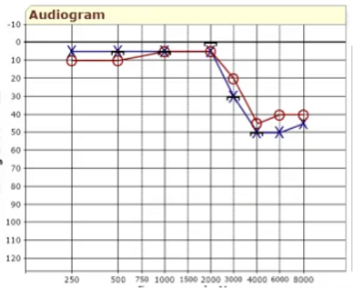 Hearing test
hearing aid
hearing evaluation
audiogram
hearing loss