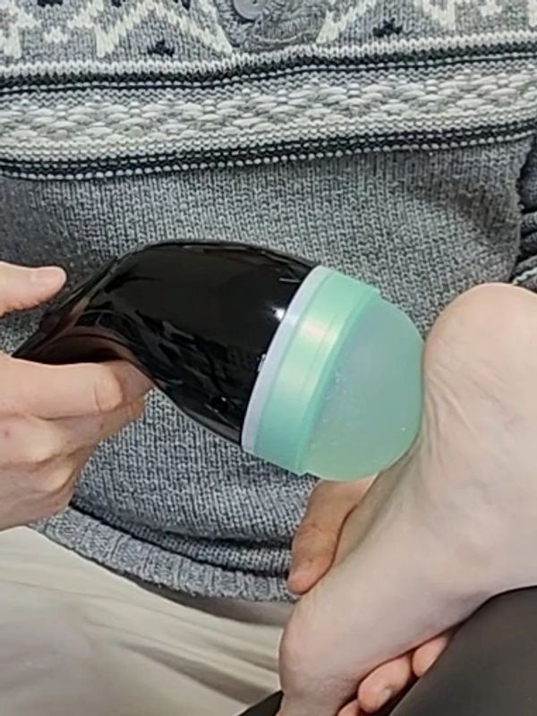 Focused shockwave therapy applied to the heel for plantar fasciitis