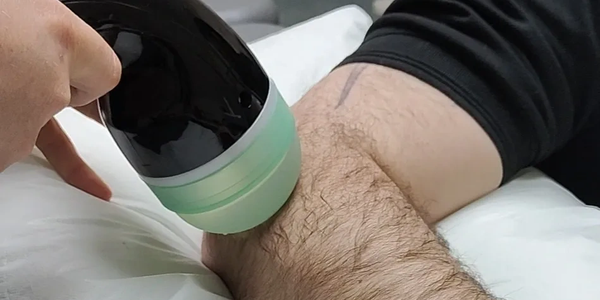 shockwave  therapy for tennis elbow 