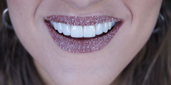 Diseño de sonrisa