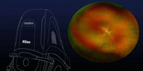 Nikon Septo device with retinal image.