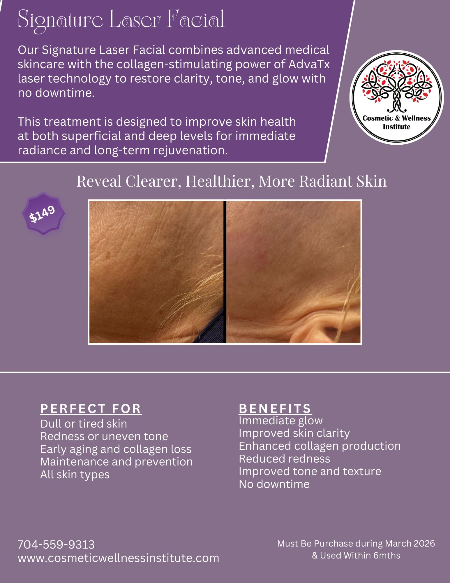 Signature Laser Facial combining a facial with the laser for maximum results.