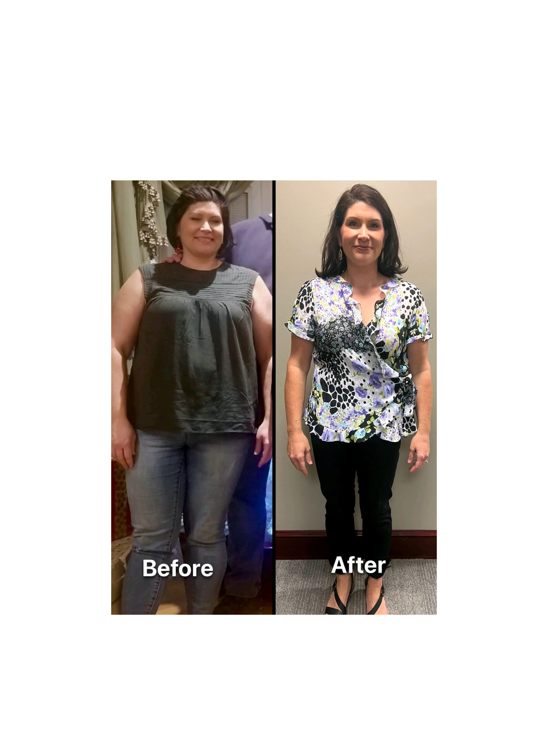 Before & After Gallery Before & After Gallery