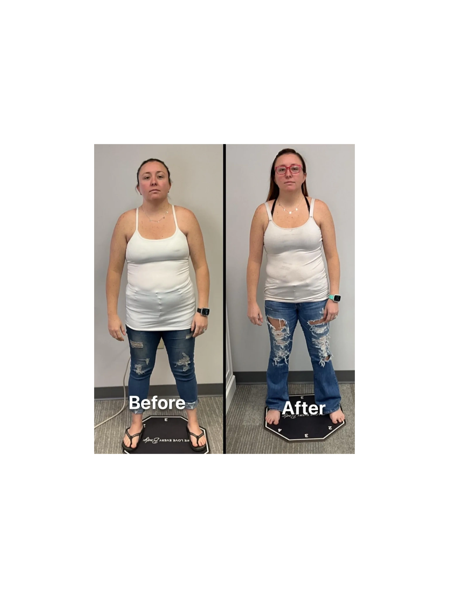 Before & After Gallery Before & After Gallery