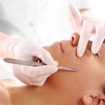Skin treatment with a scalpel on a woman's face.