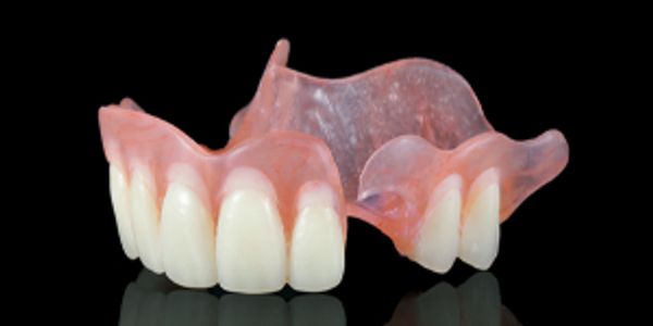 Photo of a partial