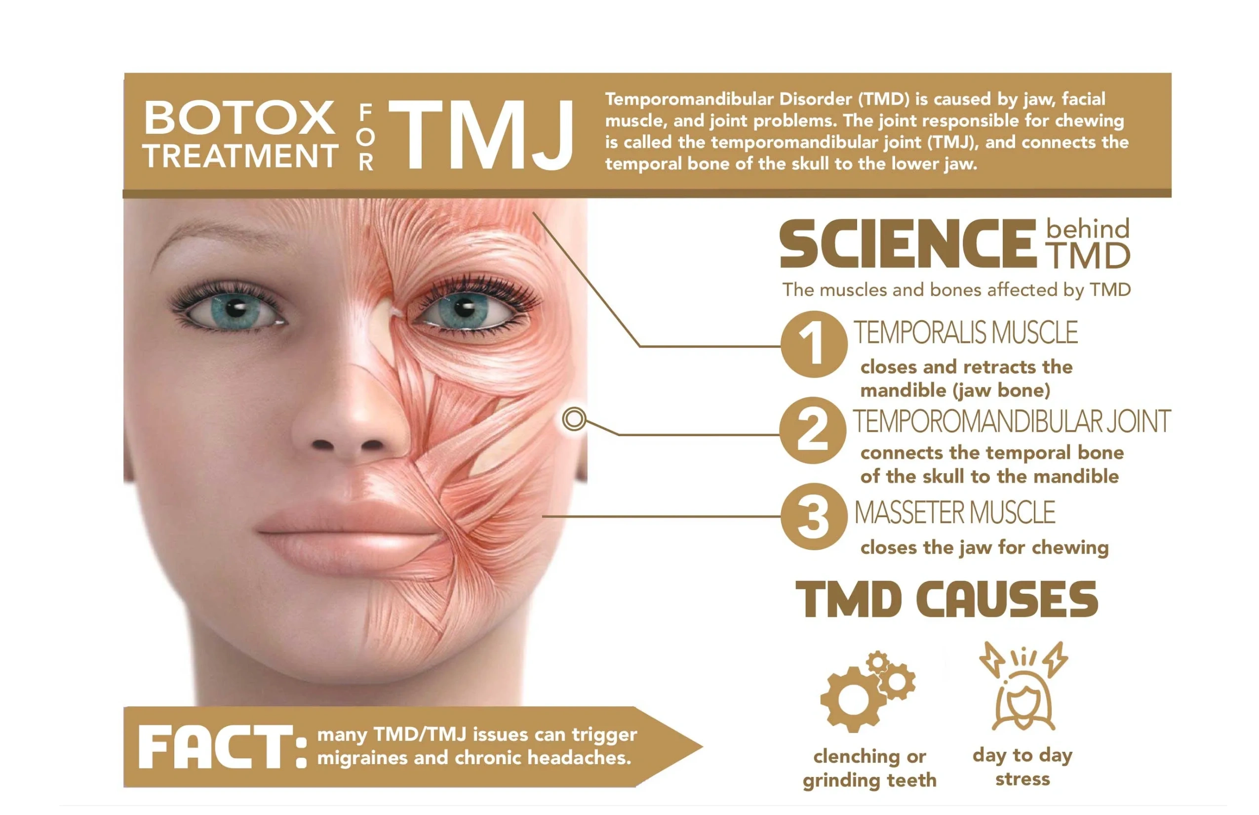 The science behind TMD. The temporalis muscle, the temporomandibular joint, and Masseter muscle