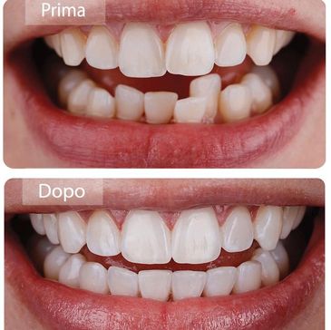 Before and after image showing significant dental improvement.