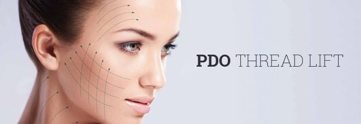 pdo thread lift/ no surgical face lift/ thread /no ivansive face lift/ tuscaloosa pdo thread lift