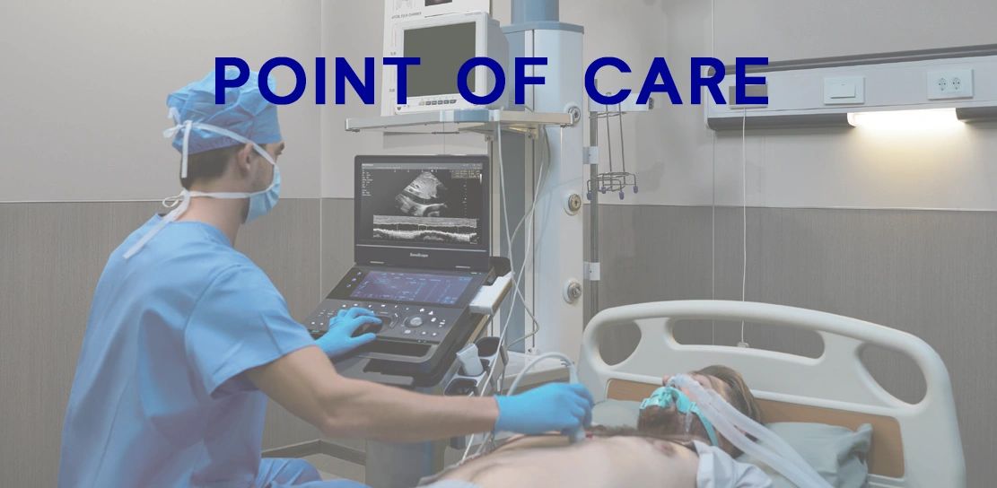SonoScape premium portable ultrasound machine on a rolling clinical cart.