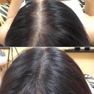 Scalp Studio - Scalp Micropigmentation - San Diego, California