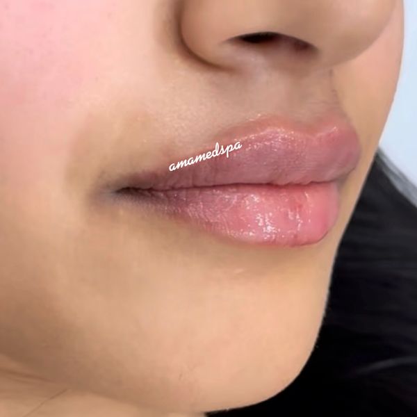 Close-up of smooth, hydrated lips with natural pink tone.