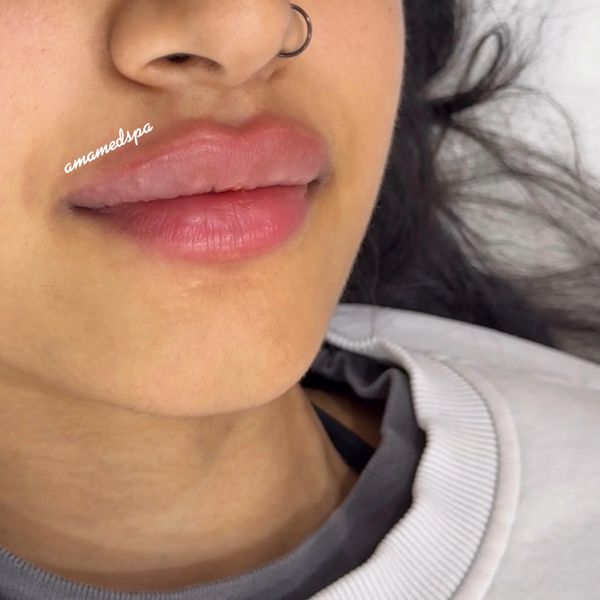 Close-up of plump, well-moisturized lips with a septum piercing.