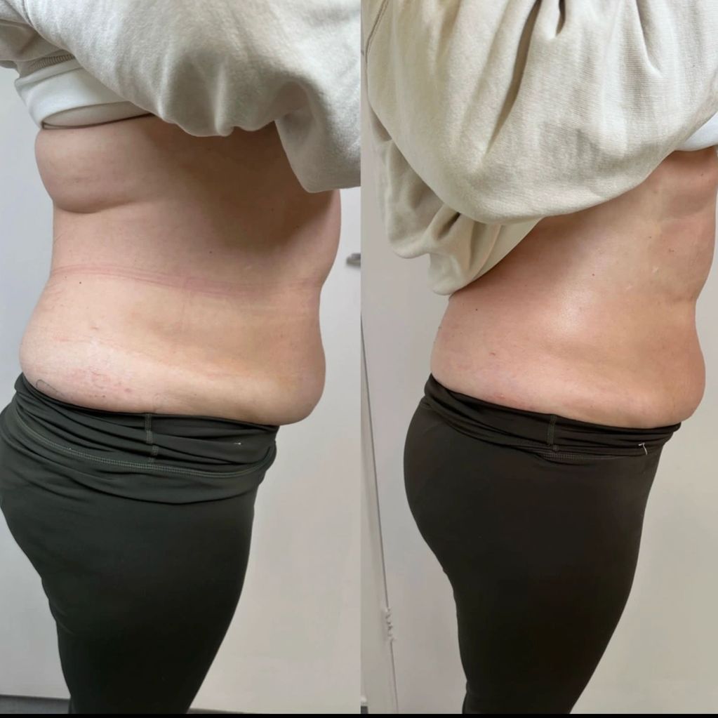 4 Months Postpartnum
Core Restore Protocol 