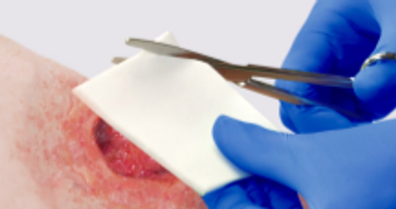 Wound care, cutting collagen to fit the wound shape 