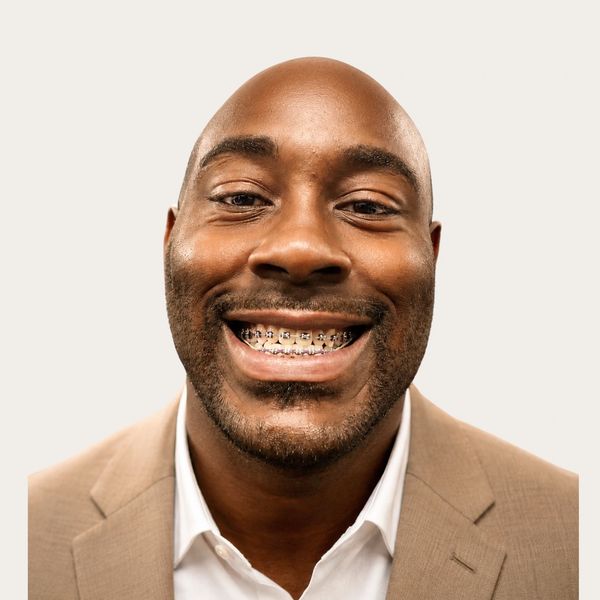 Smiling man with braces wearing a beige suit jacket and white shirt.