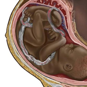 Medical Apartheid - Balm in Gilead for Communities of Color