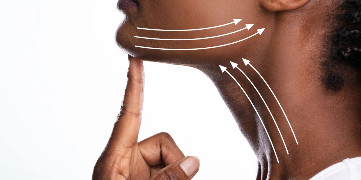 A young black woman has contoured lines on her face showing where the Thesera L treatment will work