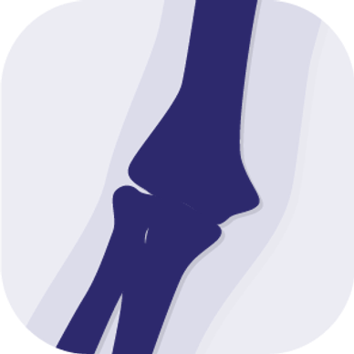 Stylized illustration of a human elbow joint in dark blue tones.
