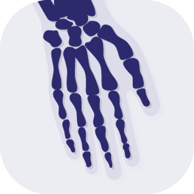 X-ray image showing the bones of a human hand.
