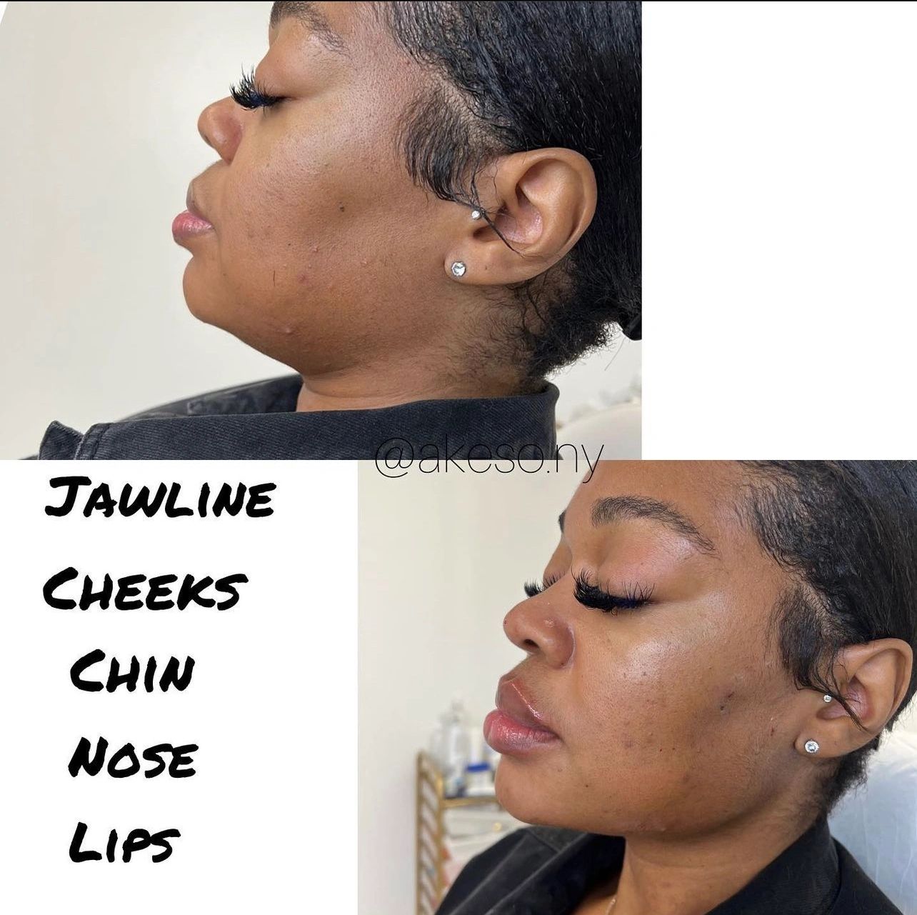 FACIAL BALANCING 