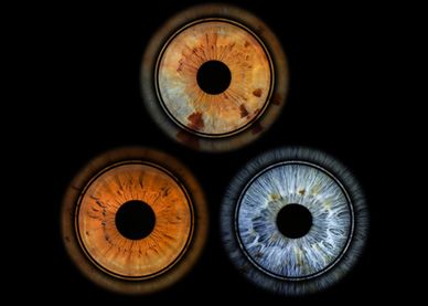 Three close-up eye irises with distinct colors on a black background.