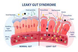 leaky gut versus healthy gut
