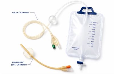 Foley and suprapubic catheters with drainage bag.
