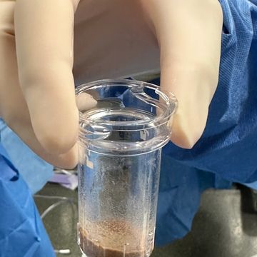 Gloved hand holding a small container with a brownish substance.