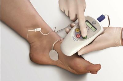 Device applying electrical stimulation to a foot.
