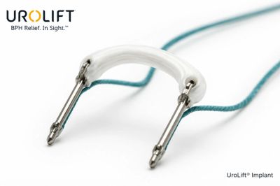 UroLift implant device for BPH relief.