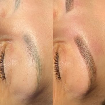 Eyebrow before and after enhancement.