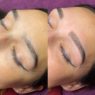 Before and after eyebrow enhancement.