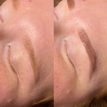 Before and after eyebrow enhancement.